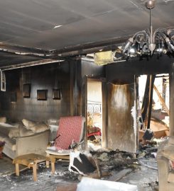 Bimtes Hasar Restorasyonu